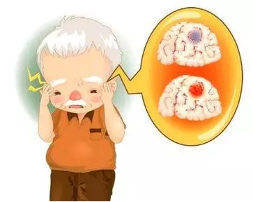 干細胞治療神經系統(tǒng)疾病勝利案例匯總