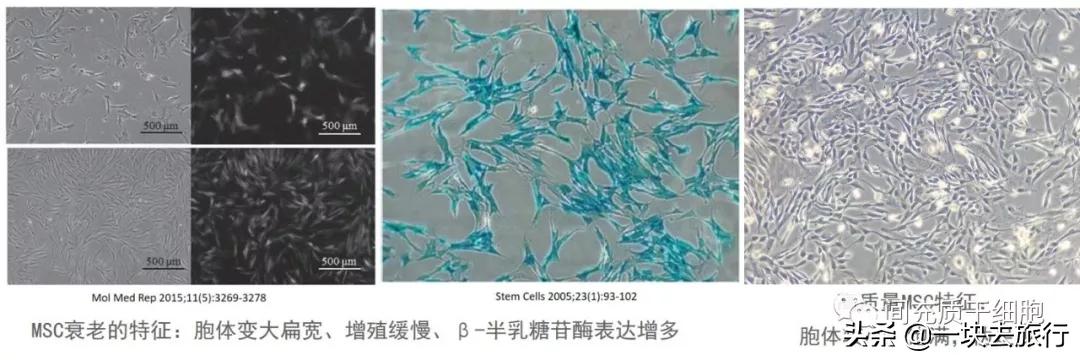間充質干細胞MSC的功能特性和臨床挑戰(zhàn)