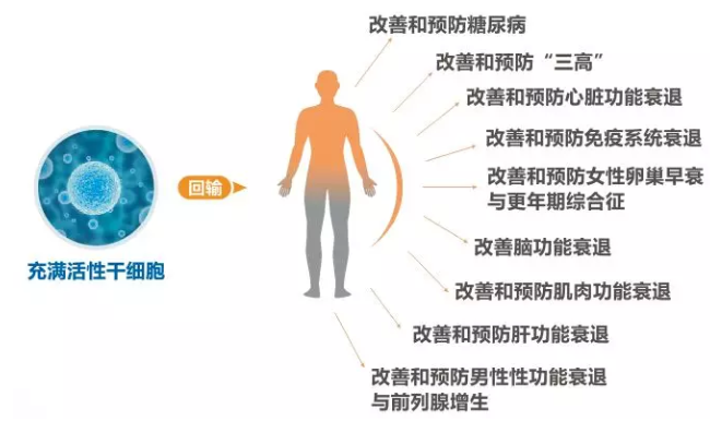 干細胞療法注射關(guān)節(jié)腔或?qū)⒊蔀橹委熽P(guān)節(jié)炎的最