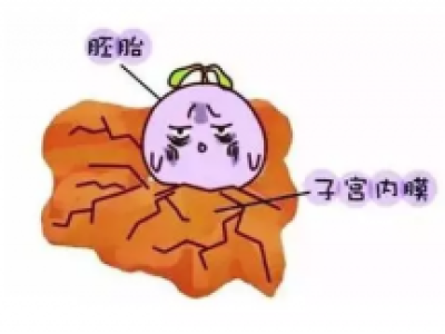 干細(xì)胞對(duì)于子宮內(nèi)膜再生修復(fù)的作用